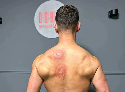 Hséra Smart Cupping Massager product image 5
